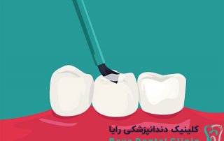 دندان پزشکی ترمیمی